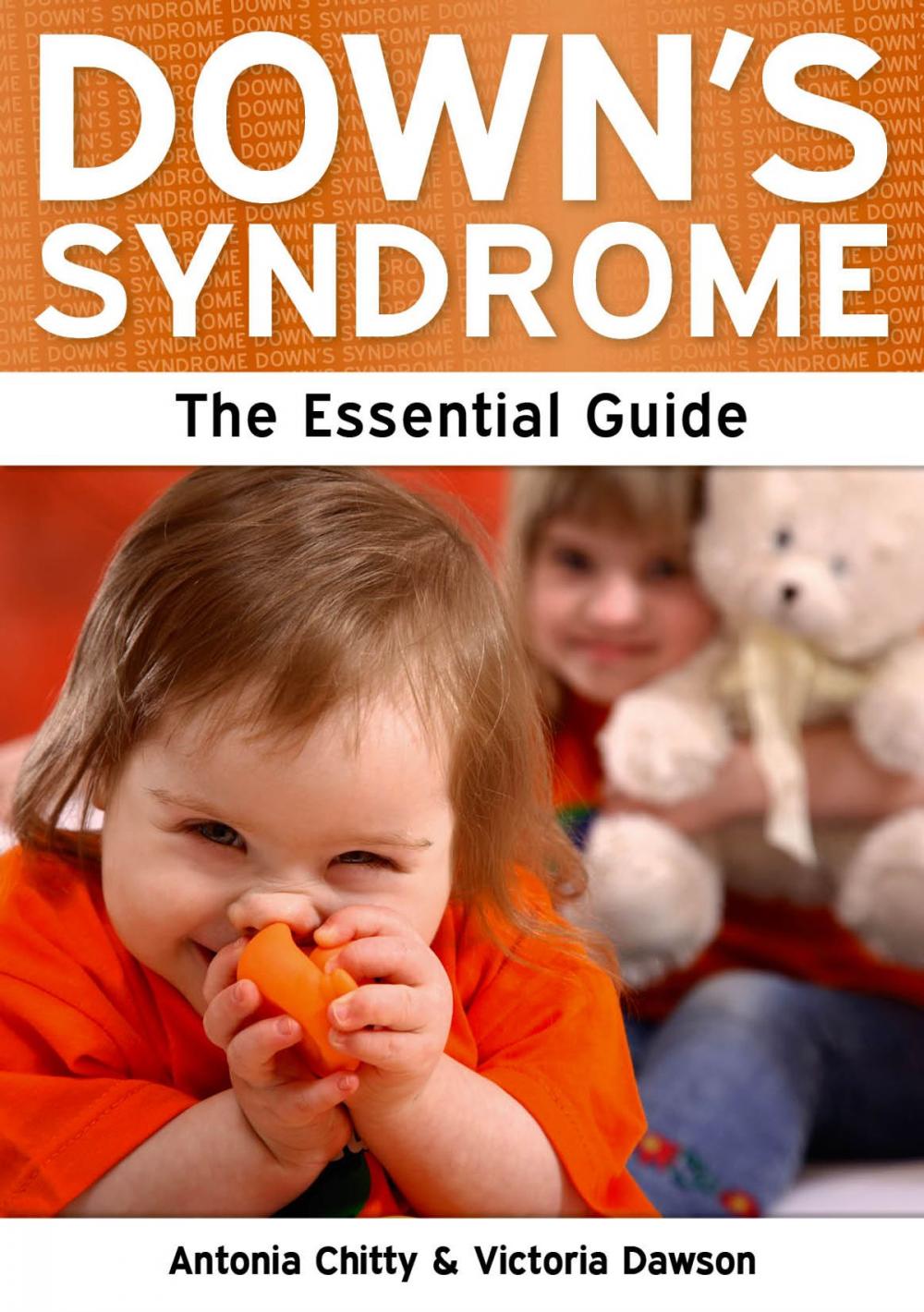 Big bigCover of Down's Syndrome: The Essential Guide