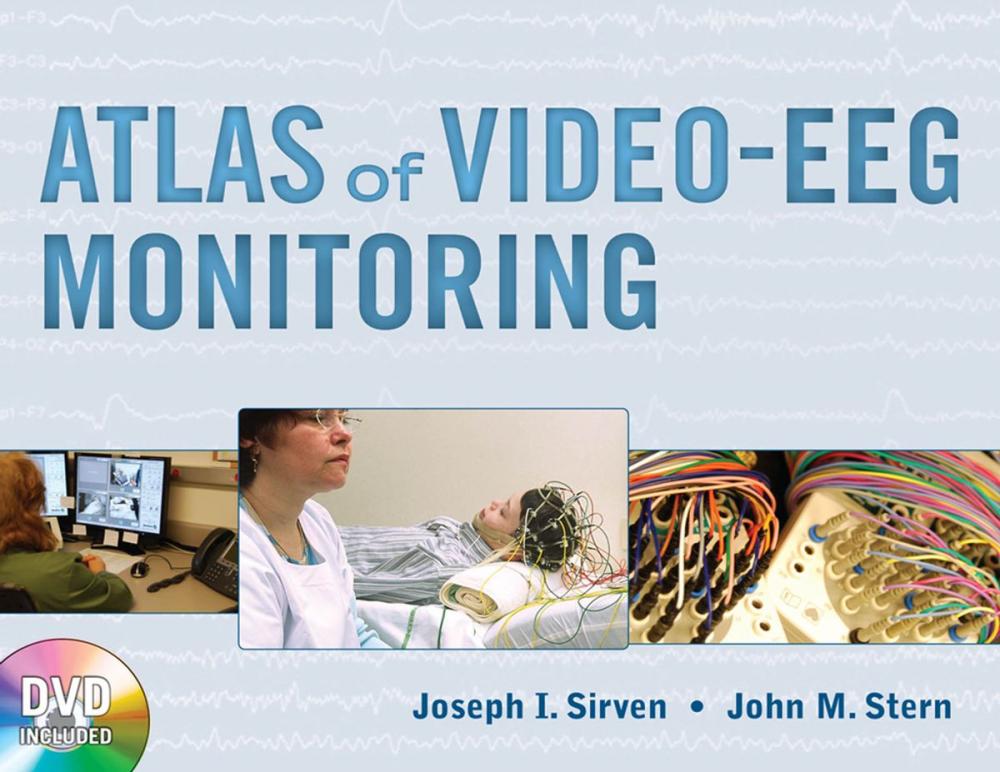 Big bigCover of Atlas of Video-EEG Monitoring