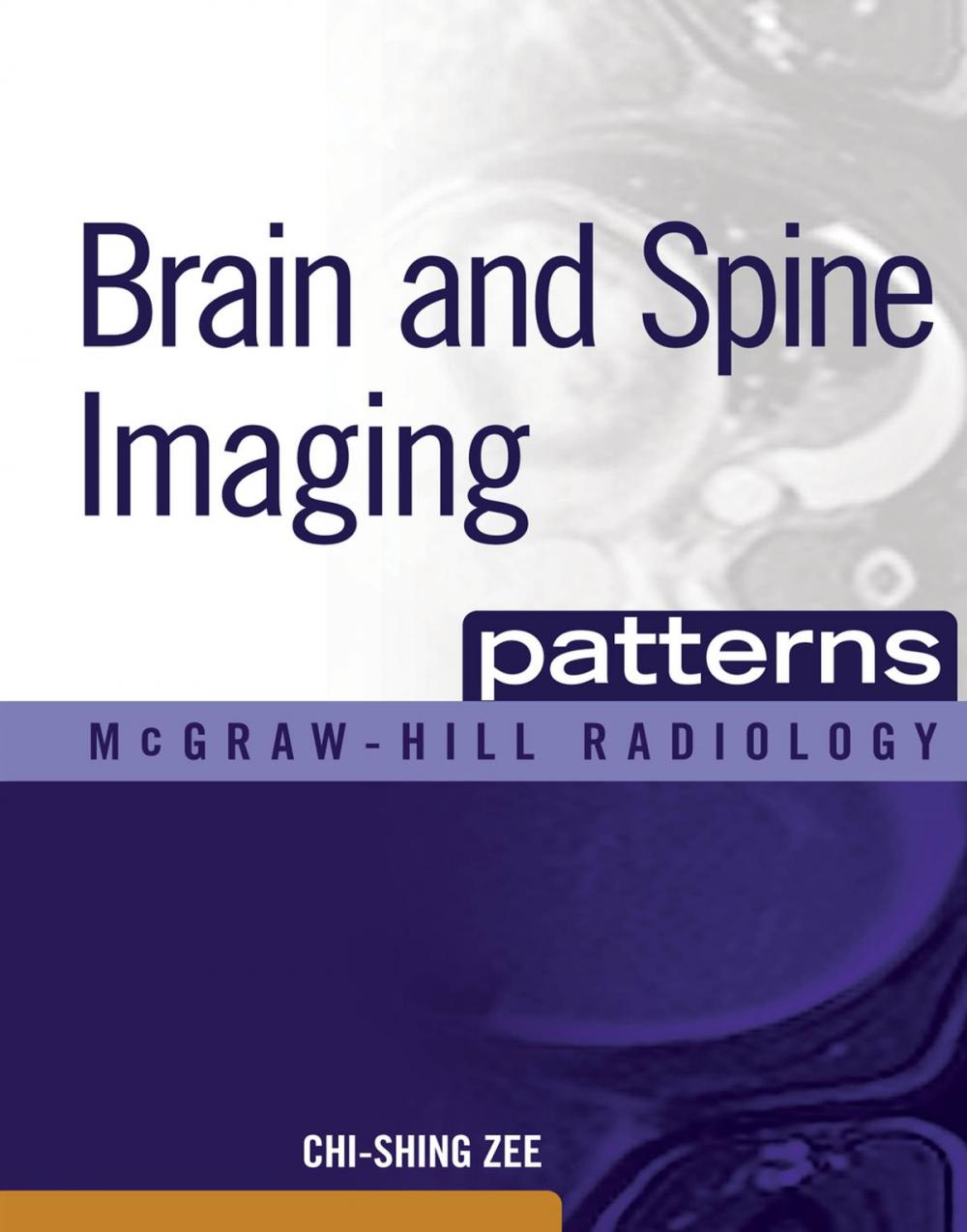 Big bigCover of Brain and Spine Imaging Patterns