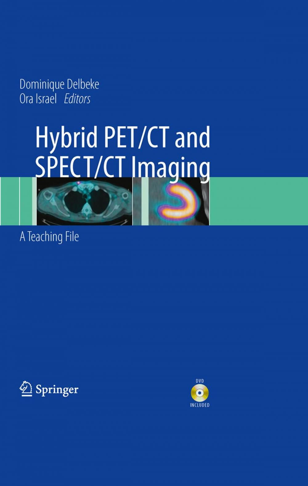 Big bigCover of Hybrid PET/CT and SPECT/CT Imaging