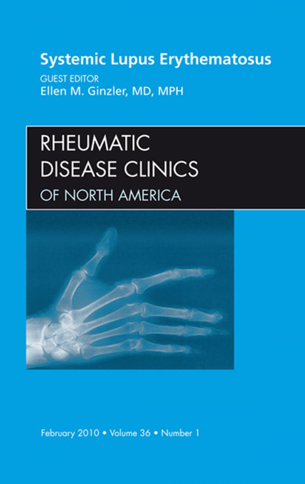 Big bigCover of Systemic Lupus Erythematosus, An Issue of Rheumatic Disease Clinics - E-Book