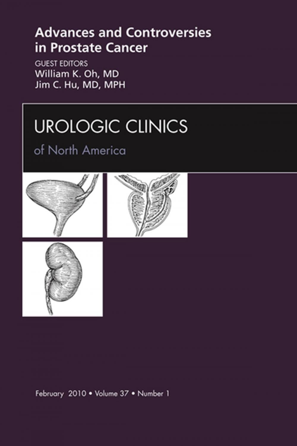 Big bigCover of Advances and Controversies in Prostate Cancer, An Issue of Urologic Clinics - E-Book