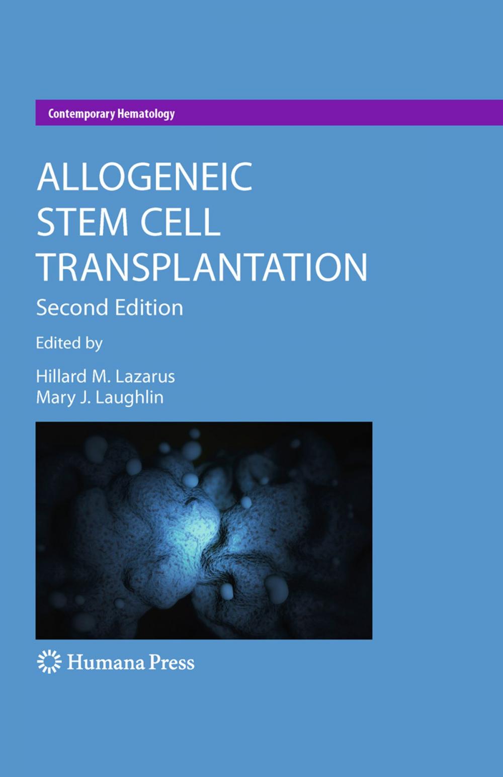 Big bigCover of Allogeneic Stem Cell Transplantation