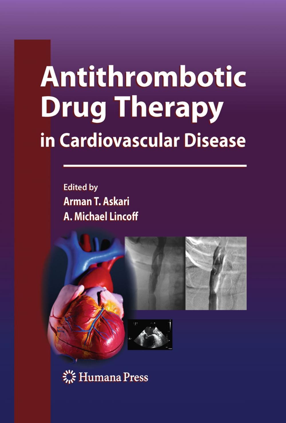 Big bigCover of Antithrombotic Drug Therapy in Cardiovascular Disease