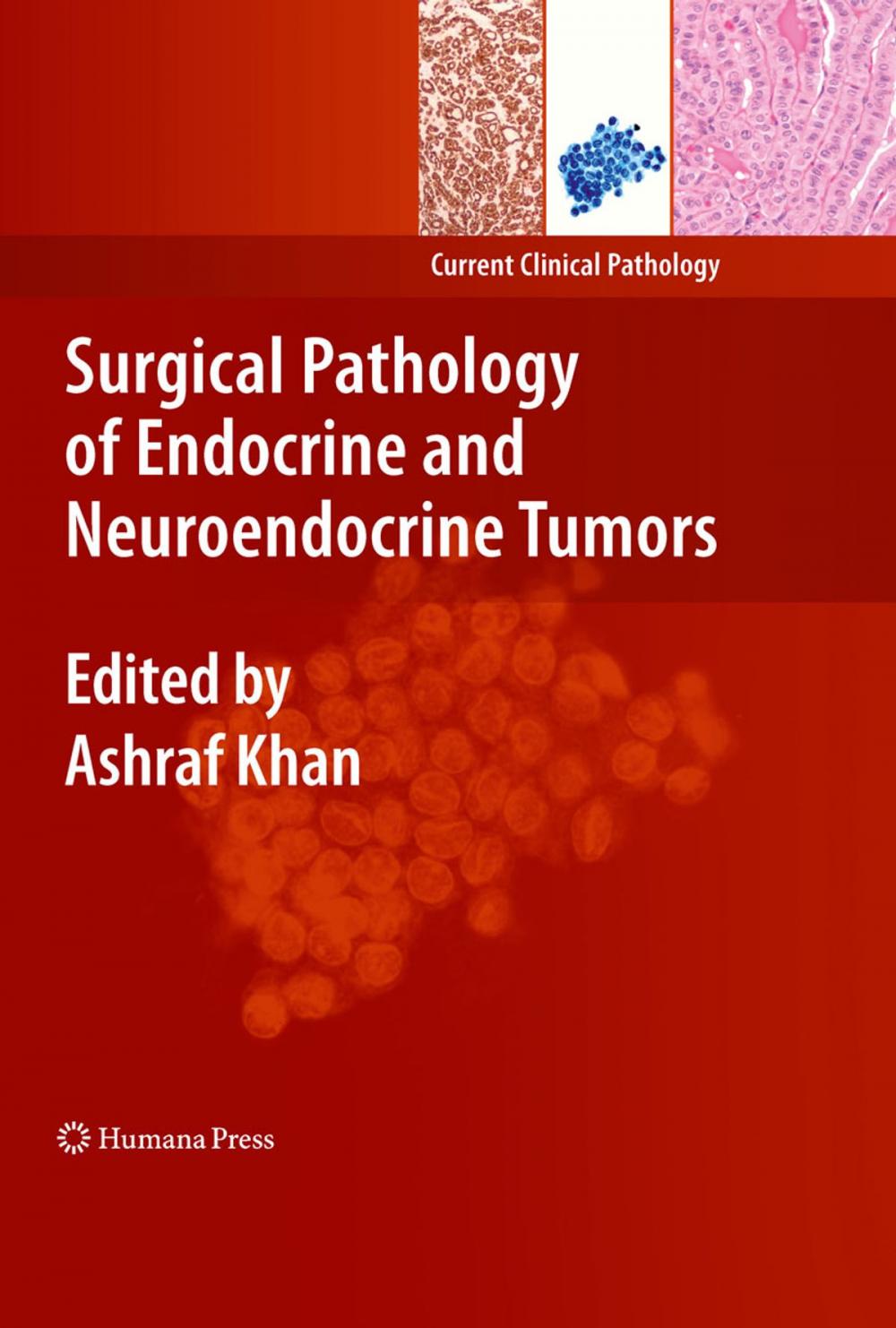 Big bigCover of Surgical Pathology of Endocrine and Neuroendocrine Tumors