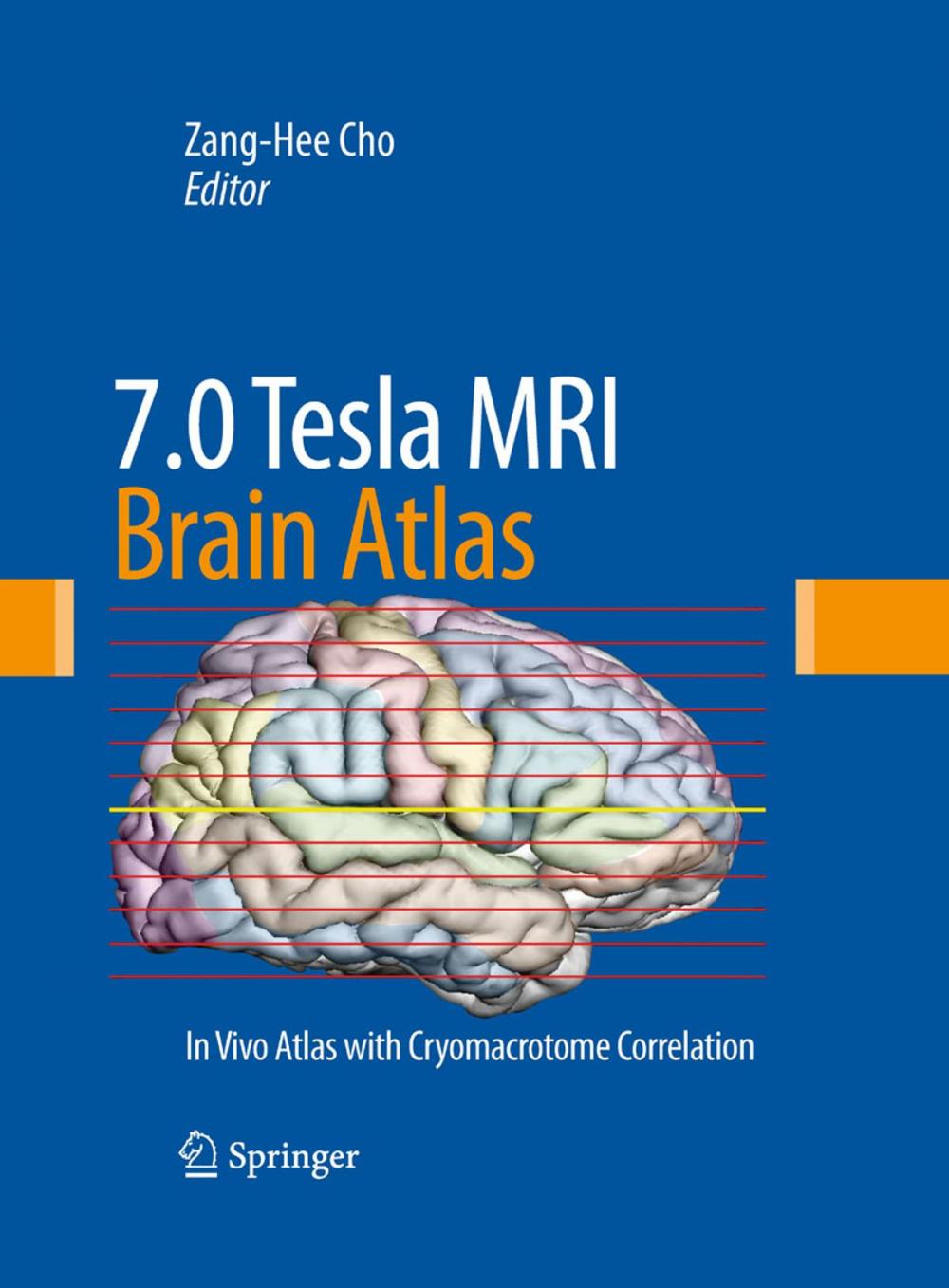 Big bigCover of 7.0 Tesla MRI Brain Atlas