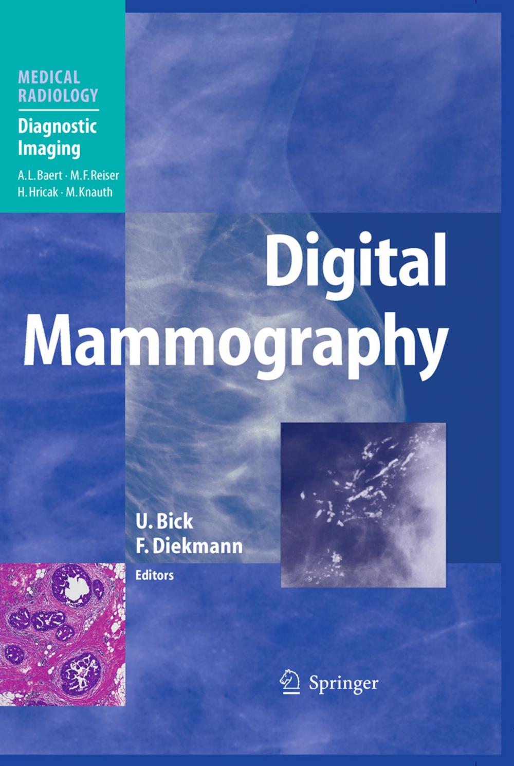 Big bigCover of Digital Mammography