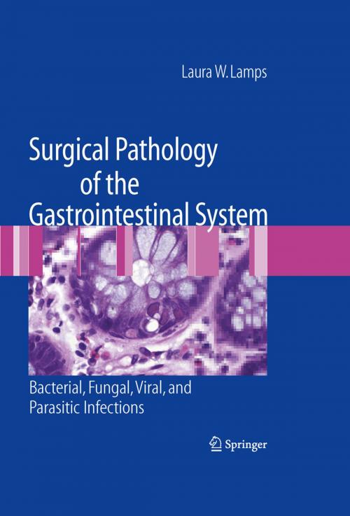 Cover of the book Surgical Pathology of the Gastrointestinal System: Bacterial, Fungal, Viral, and Parasitic Infections by Laura W. Lamps, Springer New York