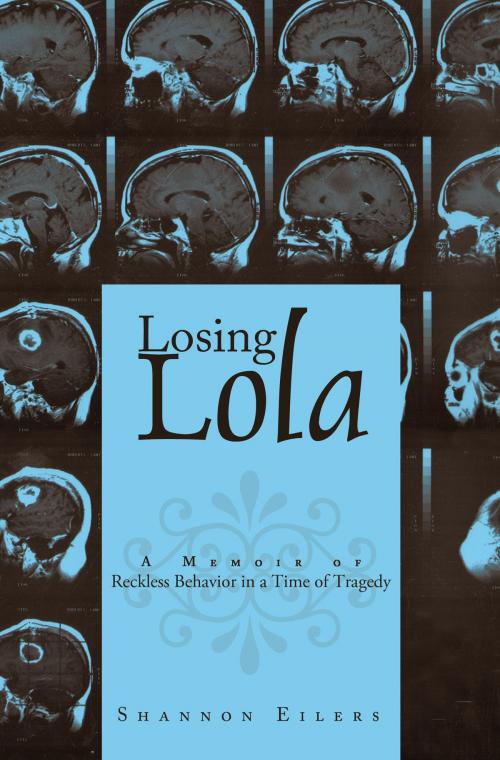 Cover of the book Losing Lola by Shannon Eilers, AuthorHouse