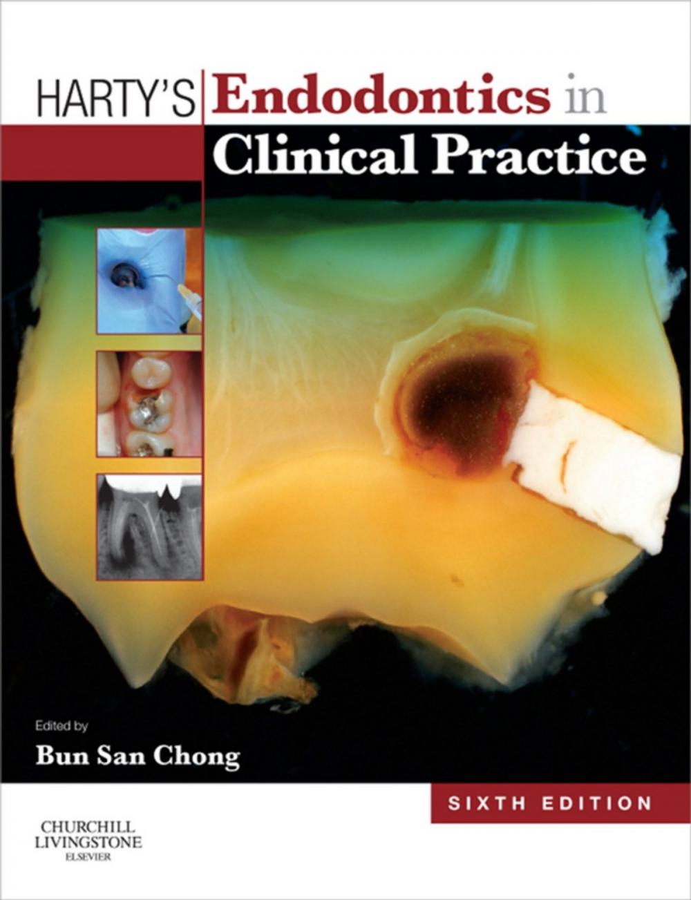 Big bigCover of Harty's Endodontics in Clinical Practice