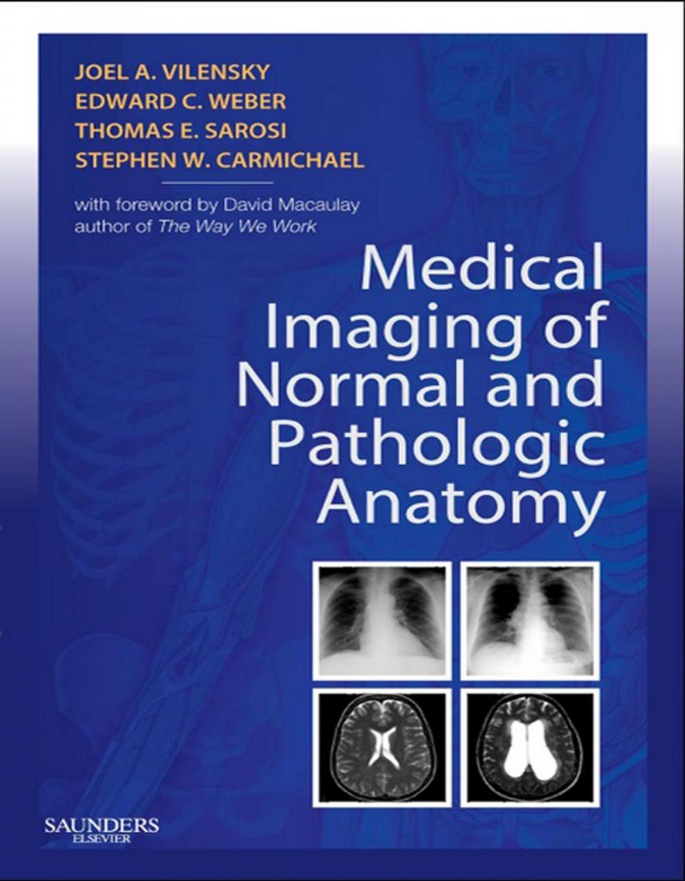 Big bigCover of Medical Imaging of Normal and Pathologic Anatomy E-Book