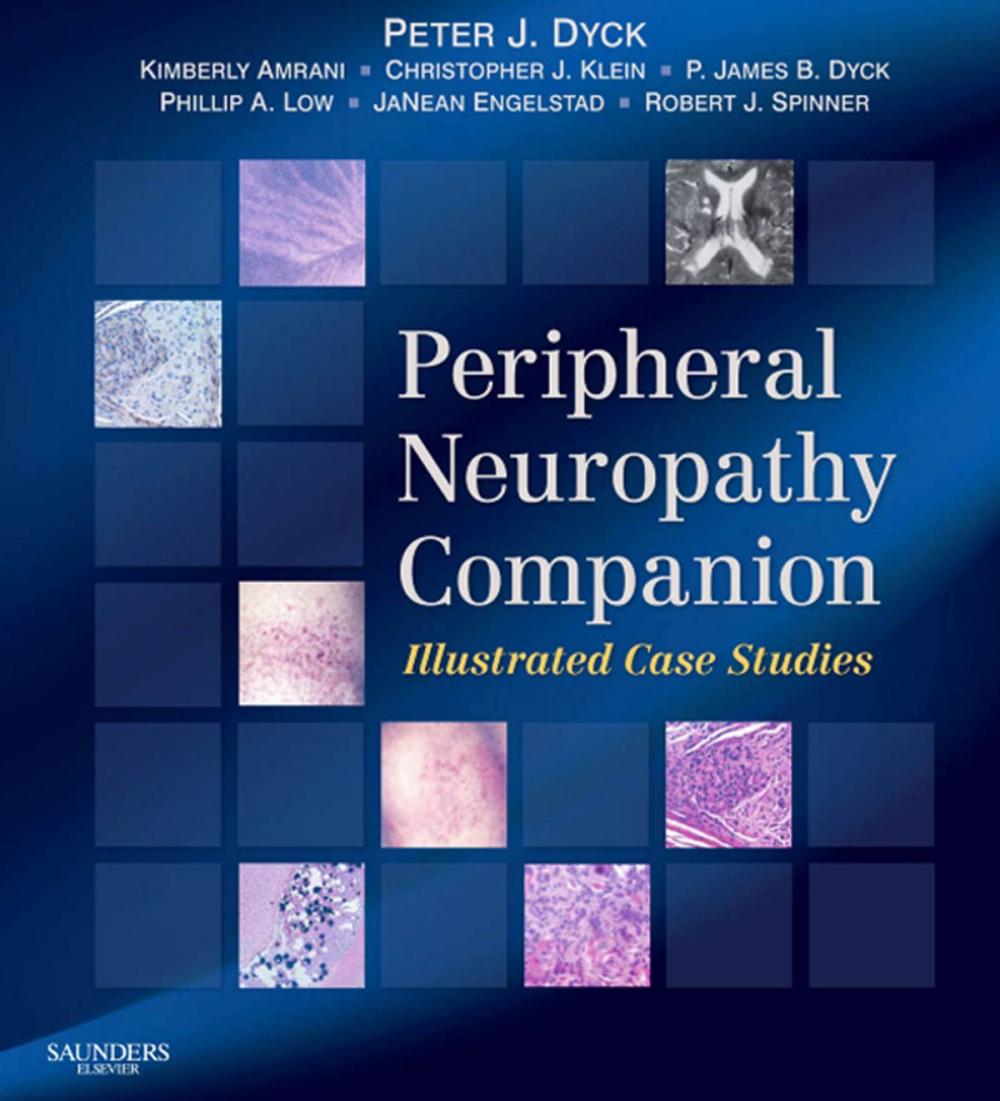 Big bigCover of Companion to Peripheral Neuropathy E-Book
