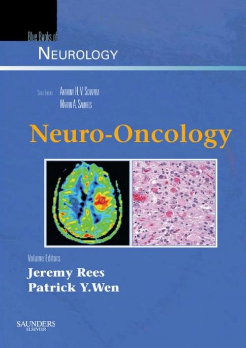 Cover of the book Neuro-Oncology E-Book by Jeremy Rees, Patrick Y Wen, Elsevier Health Sciences