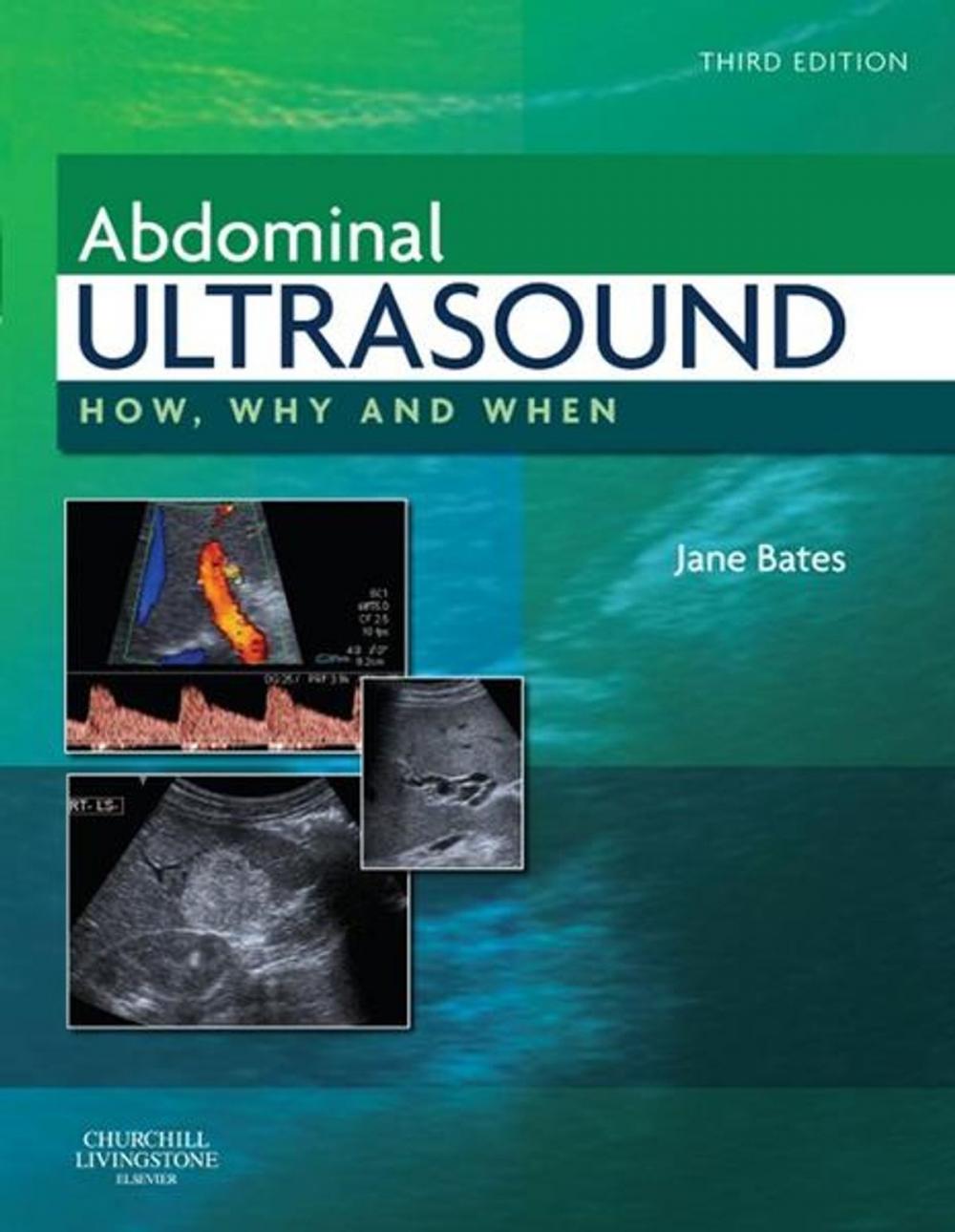 Big bigCover of Abdominal Ultrasound E-Book