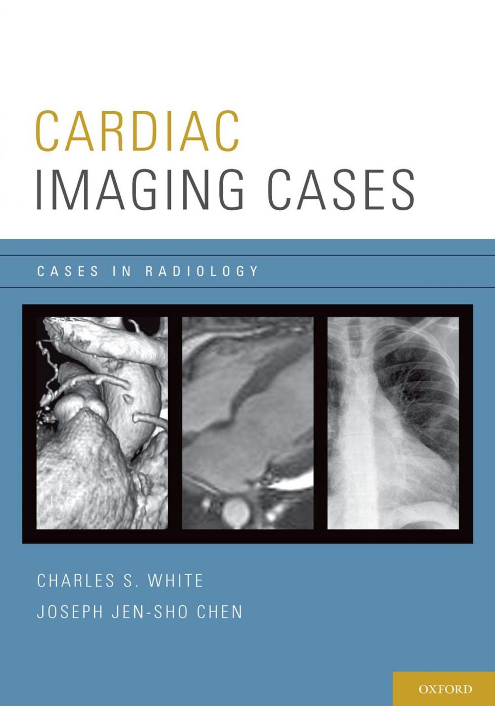 Big bigCover of Cardiac Imaging Cases