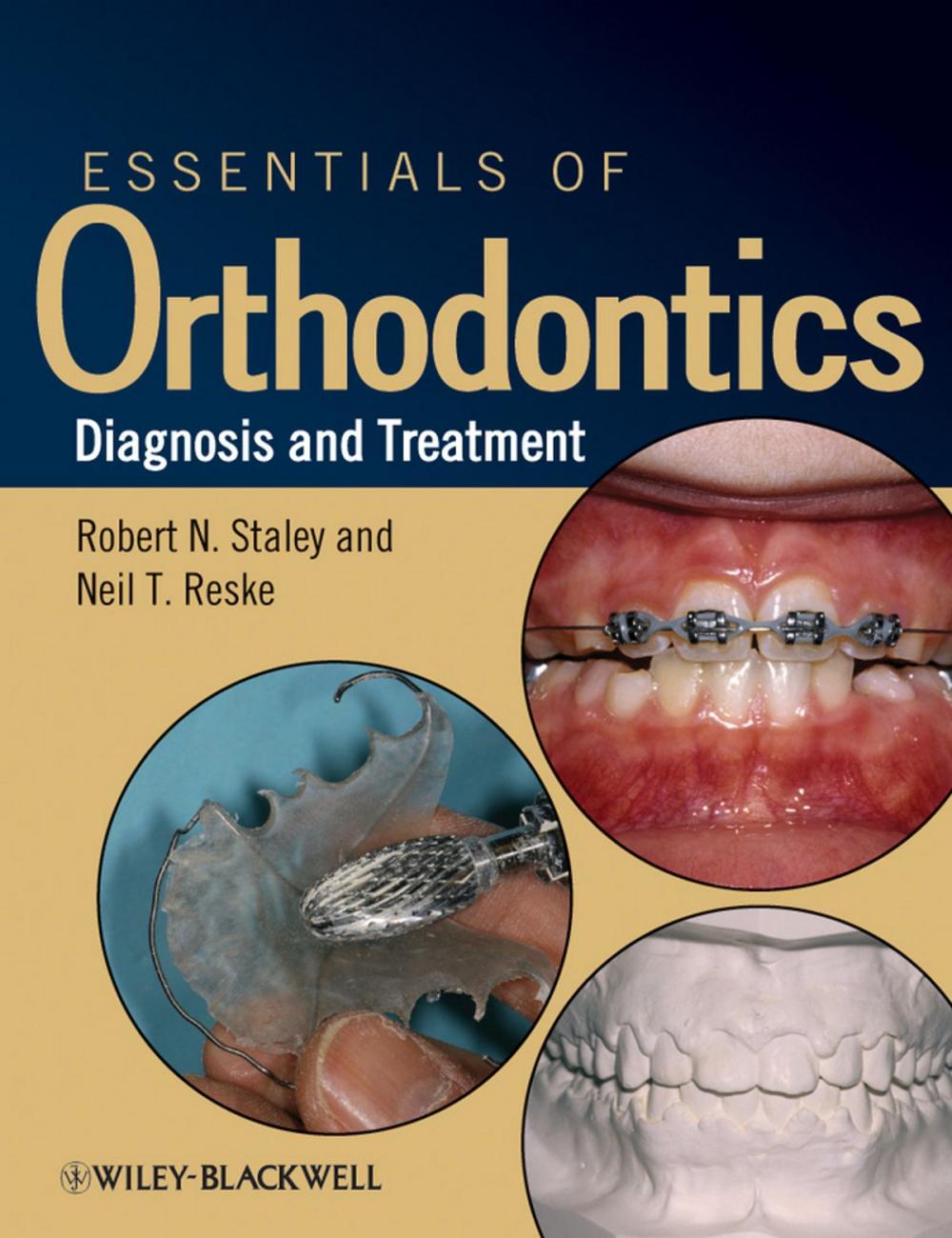 Big bigCover of Essentials of Orthodontics