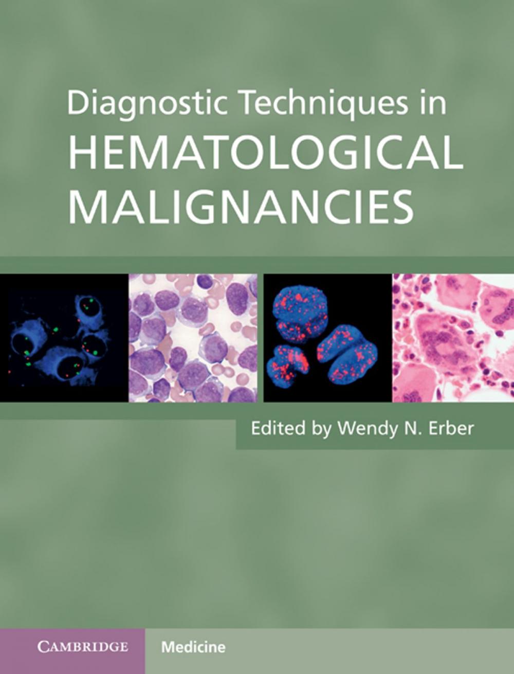 Big bigCover of Diagnostic Techniques in Hematological Malignancies