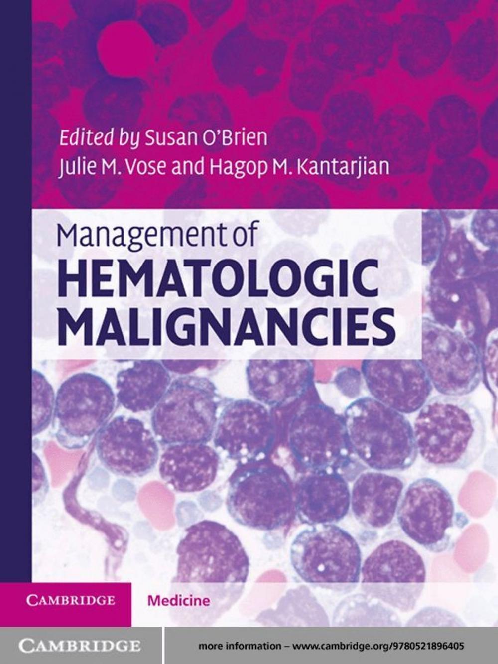 Big bigCover of Management of Hematologic Malignancies