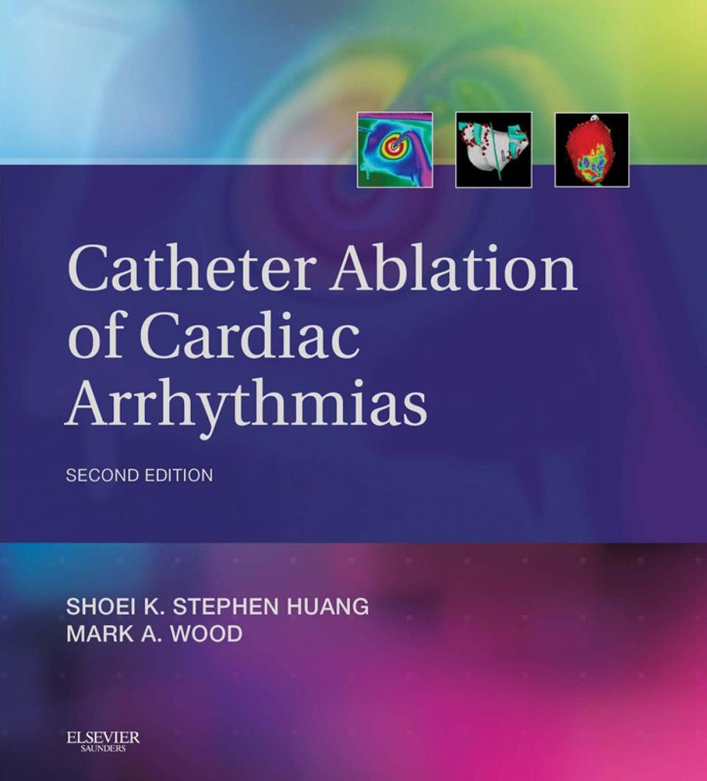 Big bigCover of Catheter Ablation of Cardiac Arrhythmias E-book