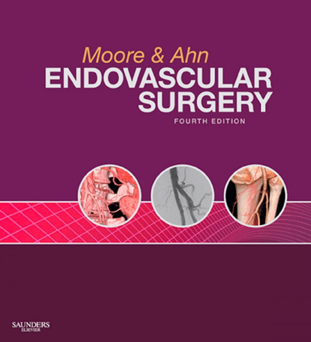 Big bigCover of Endovascular Surgery E-Book