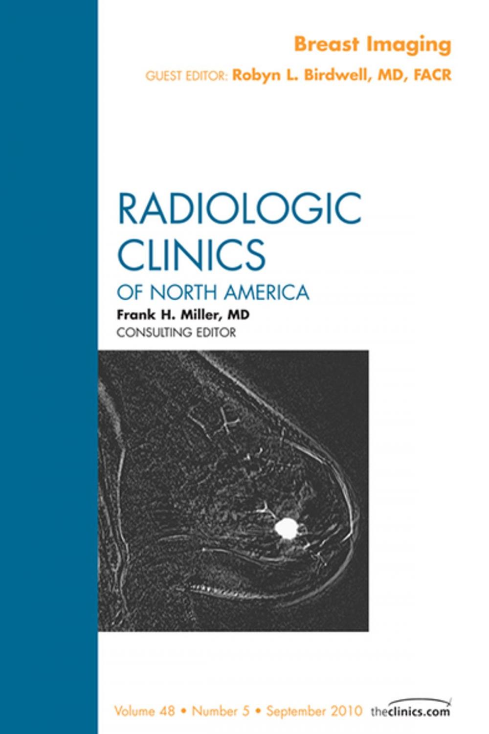 Big bigCover of Breast Imaging, An Issue of Radiologic Clinics of North America - E-Book