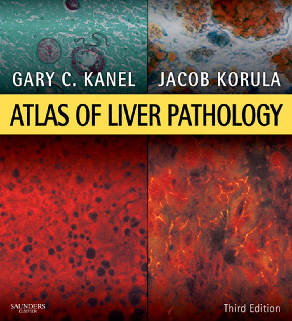 Big bigCover of Atlas of Liver Pathology E-Book