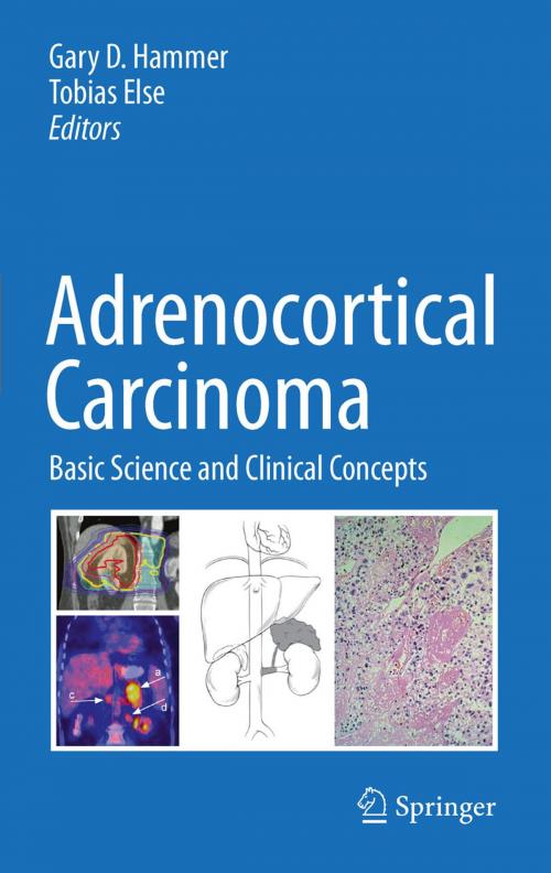 Cover of the book Adrenocortical Carcinoma by , Springer New York