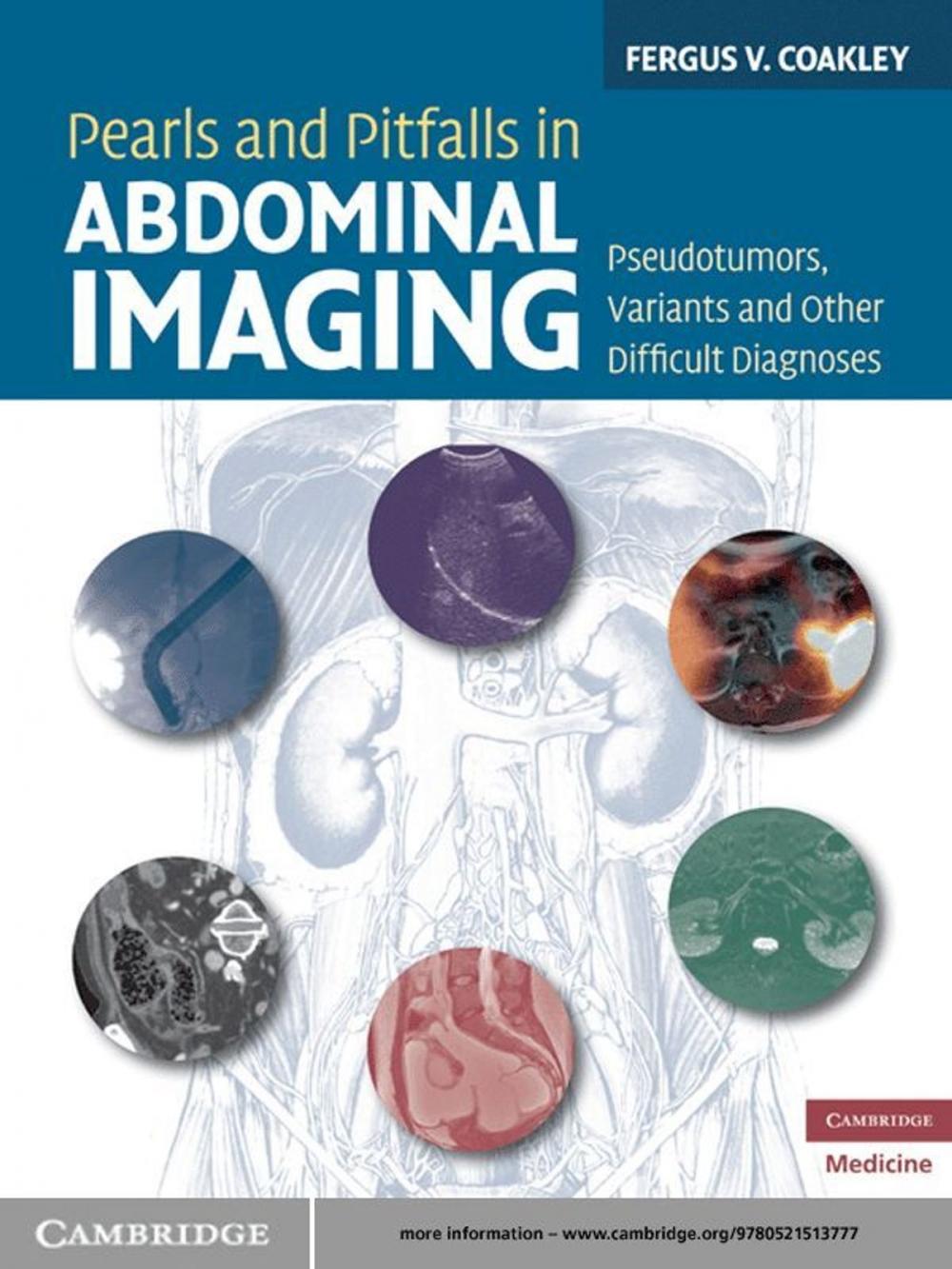 Big bigCover of Pearls and Pitfalls in Abdominal Imaging