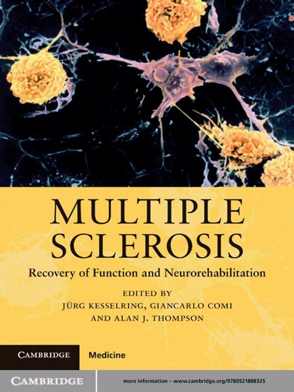 Big bigCover of Multiple Sclerosis