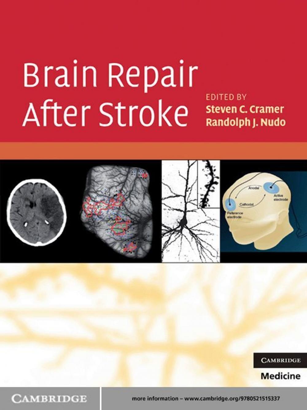 Big bigCover of Brain Repair After Stroke