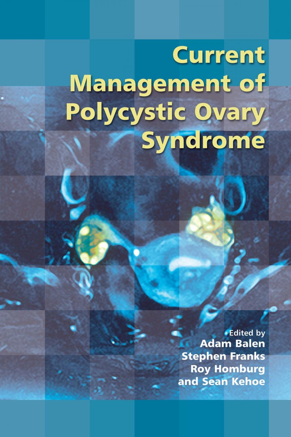 Big bigCover of Current Management of Polycystic Ovary Syndrome