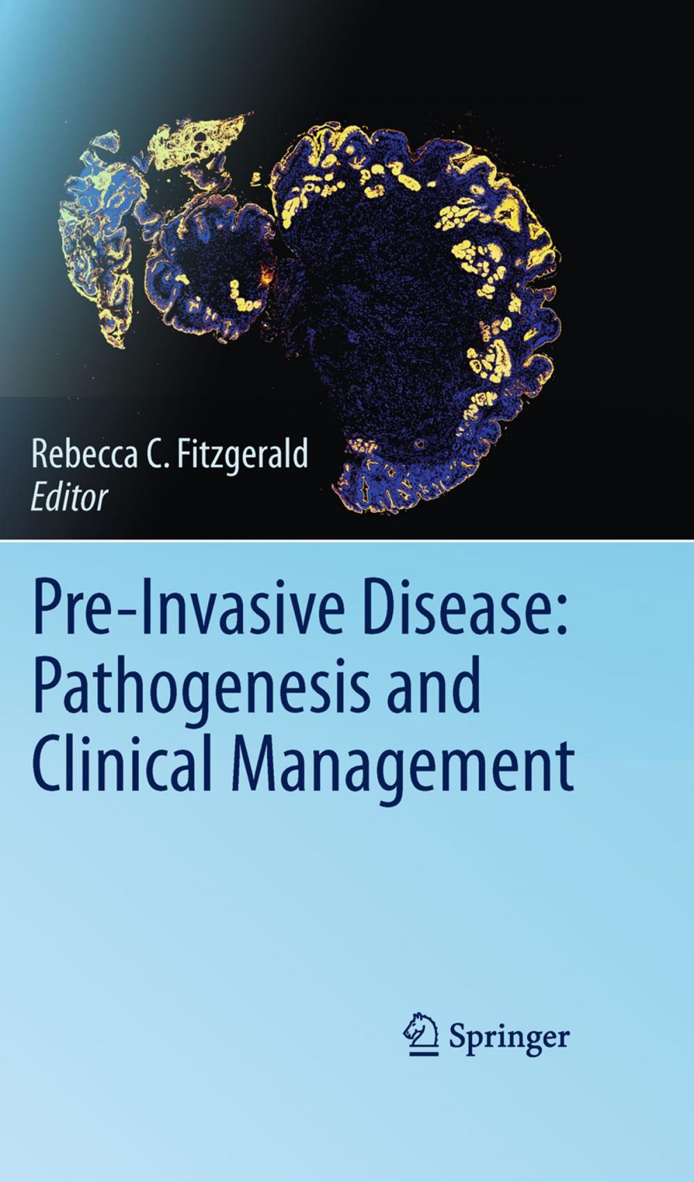 Big bigCover of Pre-Invasive Disease: Pathogenesis and Clinical Management