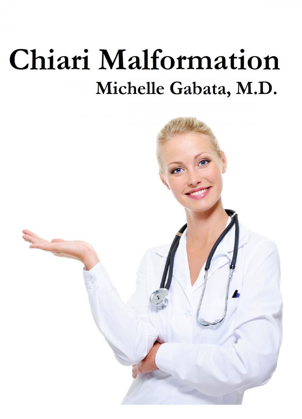 Big bigCover of Chiari Malformation: Causes, Tests, and Treatments