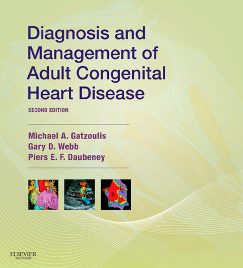 Big bigCover of Diagnosis and Management of Adult Congenital Heart Disease E-Book