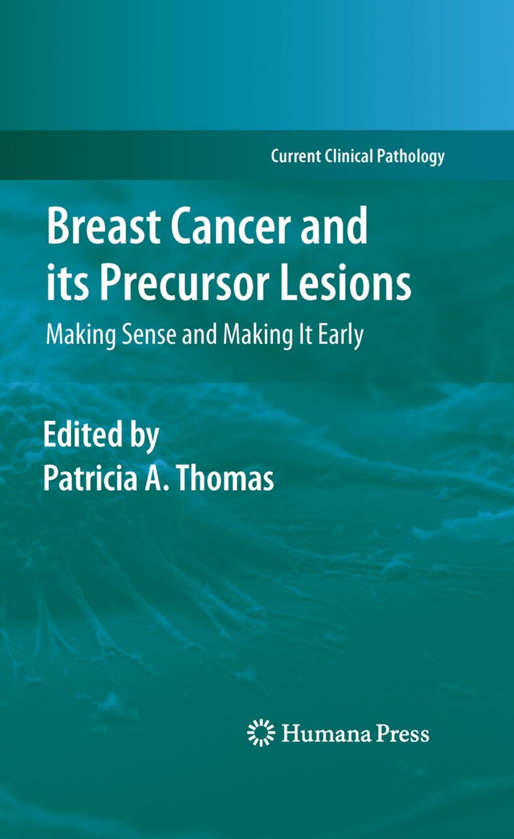 Big bigCover of Breast Cancer and its Precursor Lesions