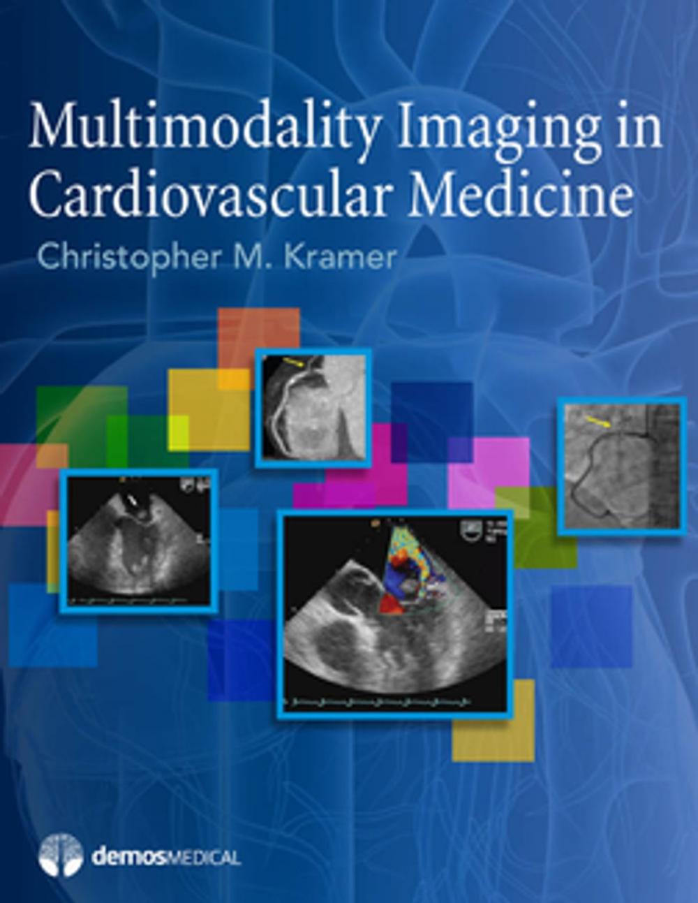 Big bigCover of Multimodality Imaging in Cardiovascular Medicine