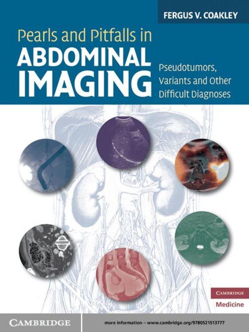 Cover of the book Pearls and Pitfalls in Abdominal Imaging by Fergus V. Coakley, MD, Cambridge University Press