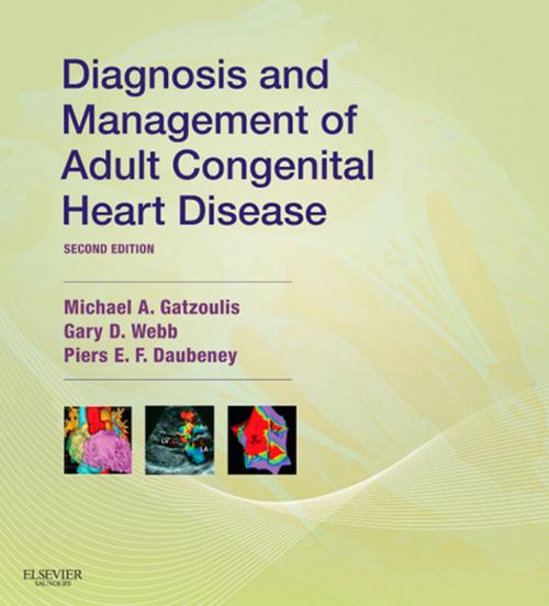 Cover of the book Diagnosis and Management of Adult Congenital Heart Disease E-Book by Michael A. Gatzoulis, MD, PhD, FACC, FESC, Gary D. Webb, MD, CM, FACC, Piers E. F. Daubeney, DM, FRCP, FRCPCH, Elsevier Health Sciences