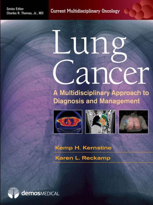 Cover of the book Lung Cancer by Charles R. Thomas Jr., MD, Springer Publishing Company