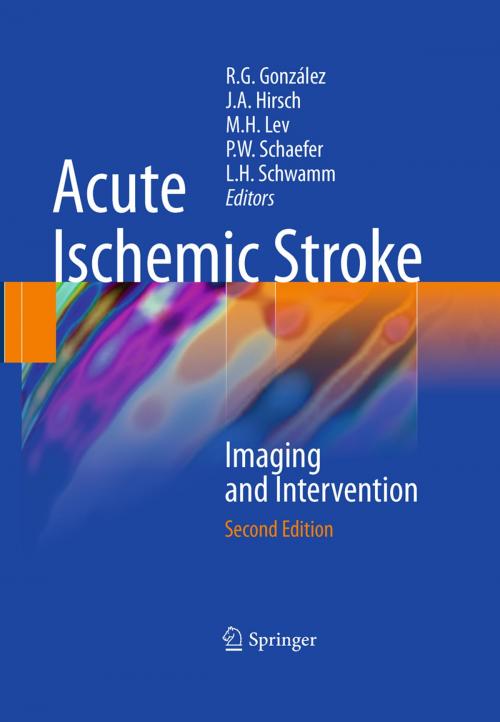 Cover of the book Acute Ischemic Stroke by , Springer Berlin Heidelberg