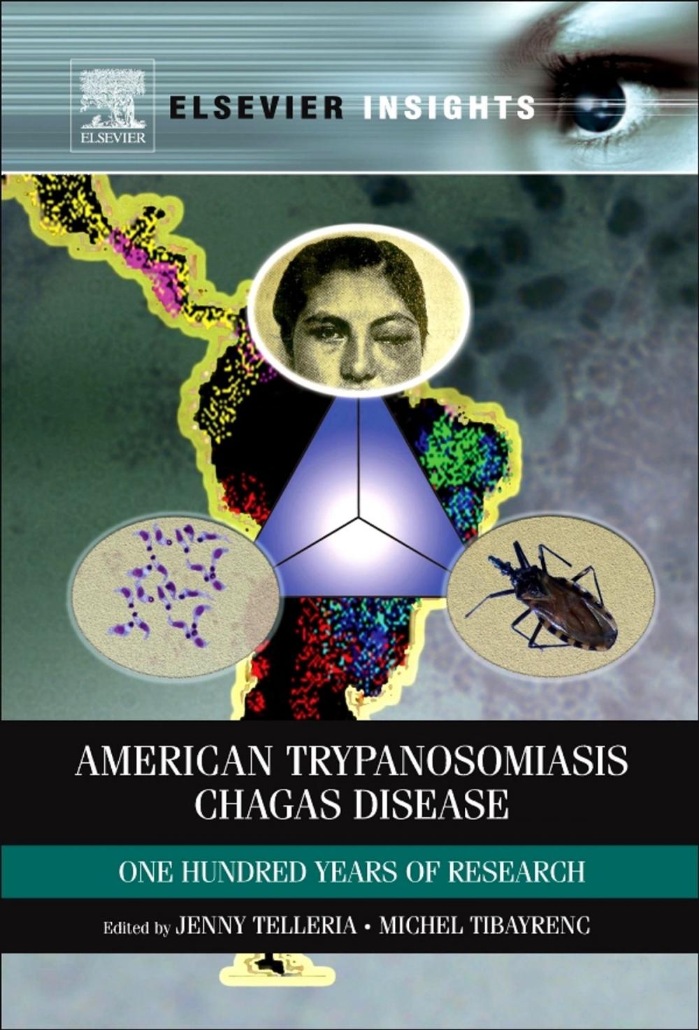 Big bigCover of American Trypanosomiasis