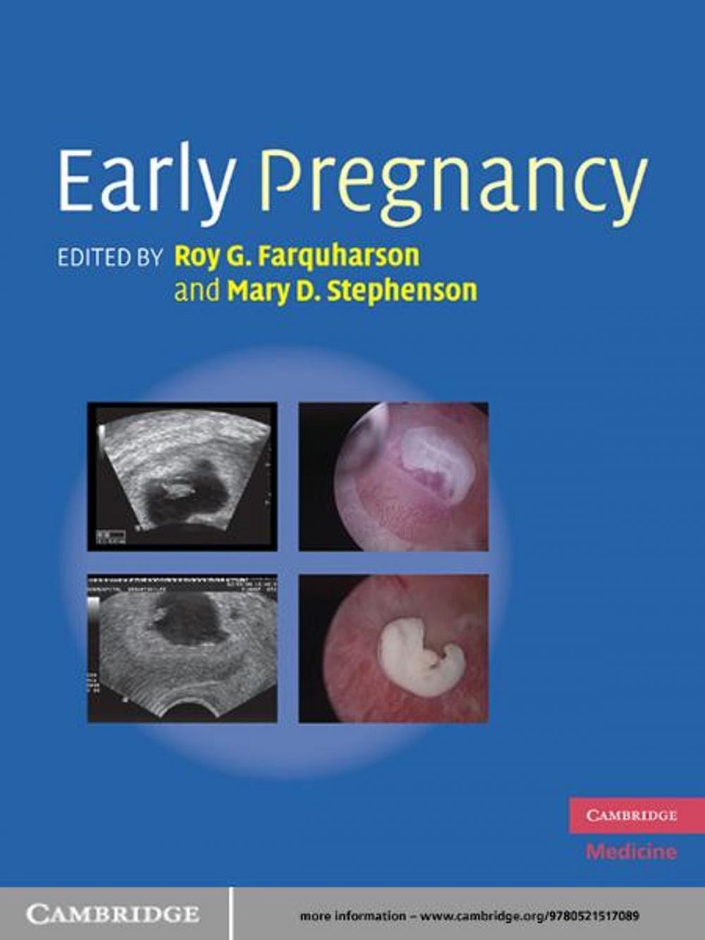 Big bigCover of Early Pregnancy