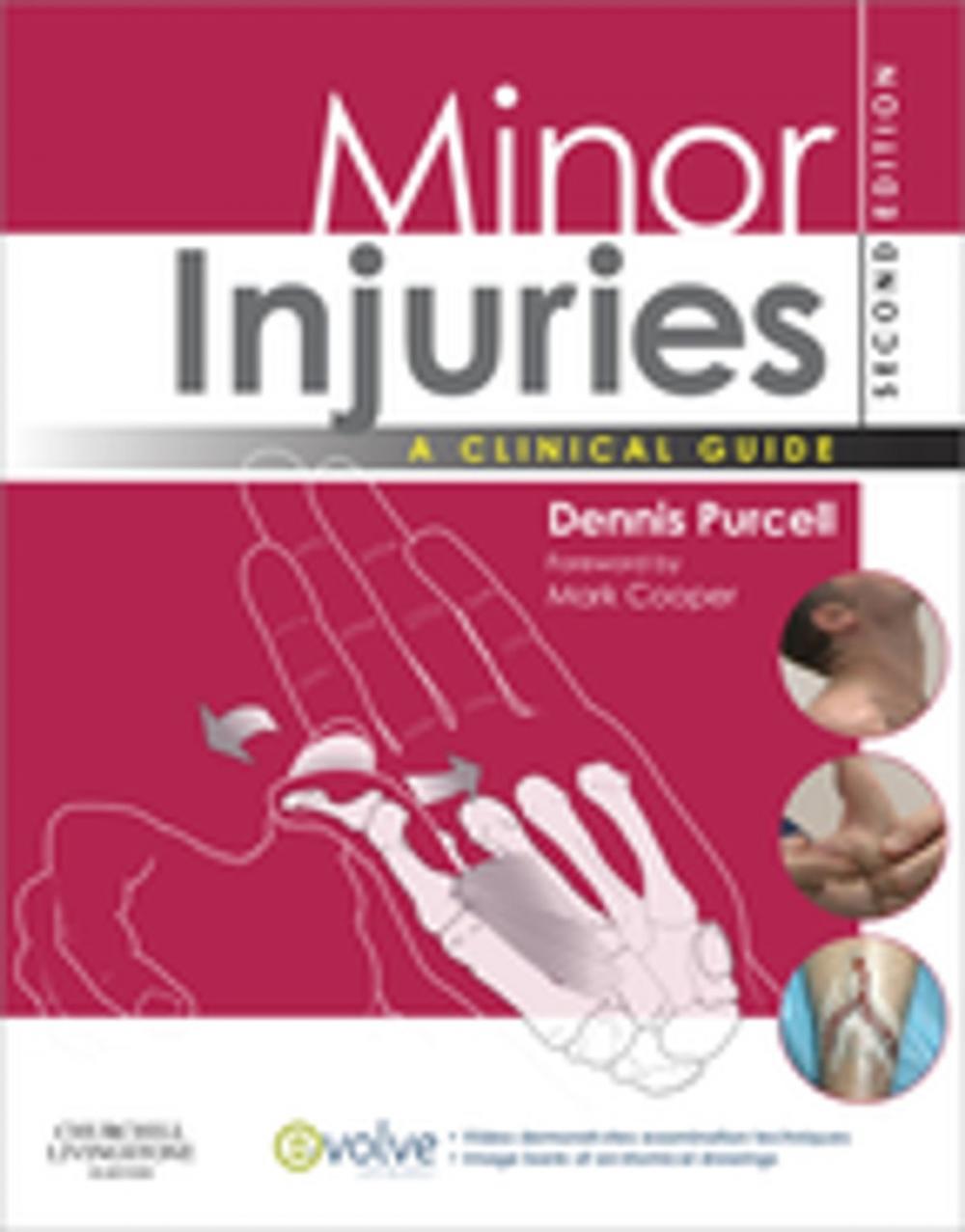 Big bigCover of Minor Injuries E-Book