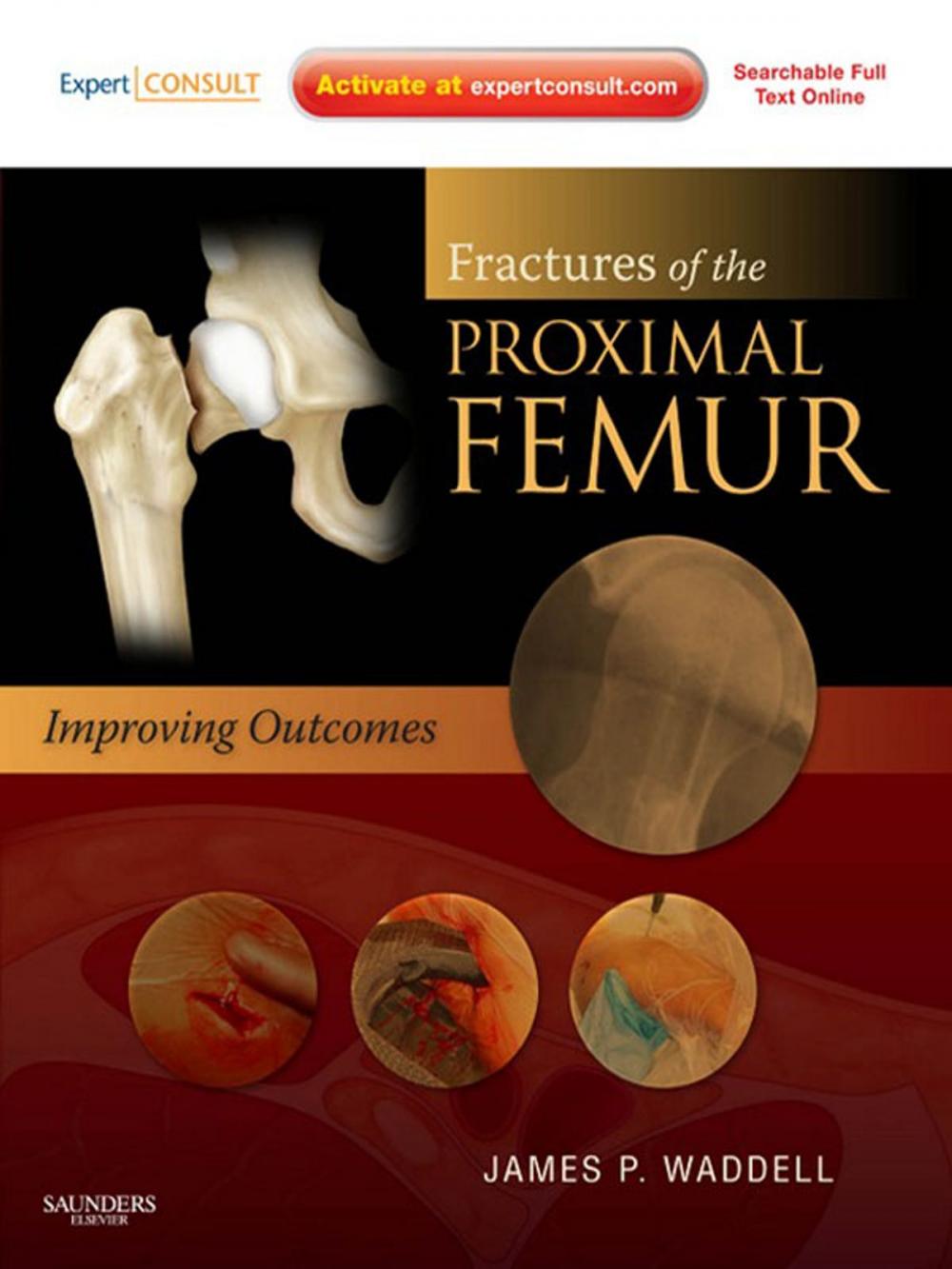 Big bigCover of Fractures of the Proximal Femur: Improving Outcomes E-Book