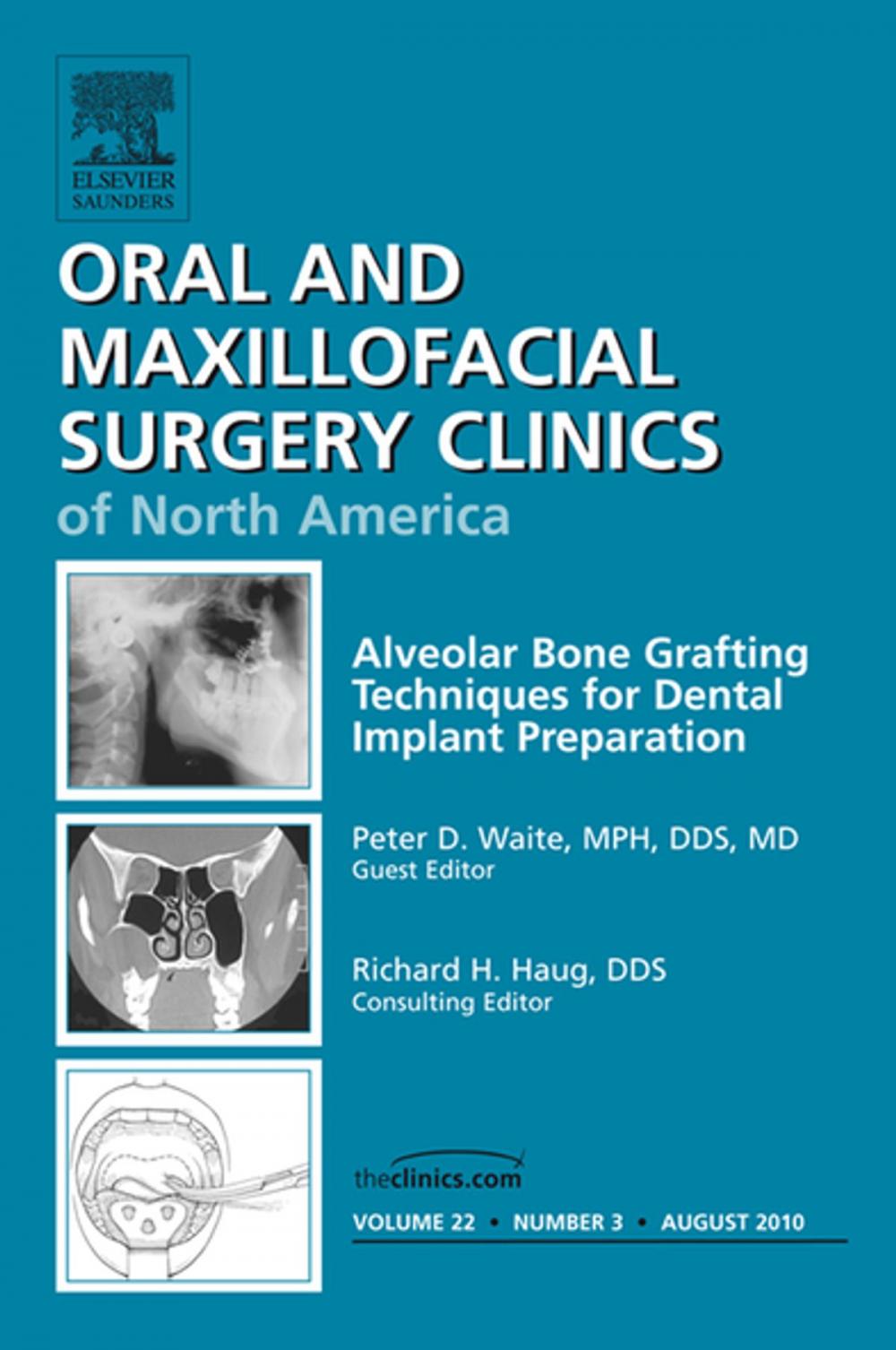 Big bigCover of Alveolar Bone Grafting Techniques in Dental Implant Preparation, An Issue of Oral and Maxillofacial Surgery Clinics - E-Book