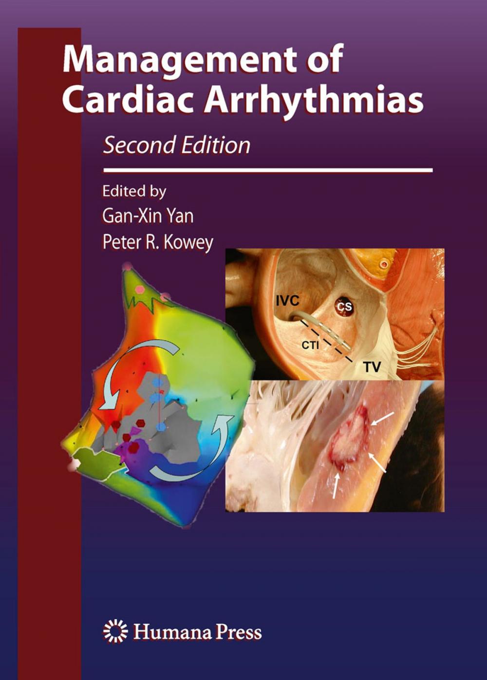 Big bigCover of Management of Cardiac Arrhythmias