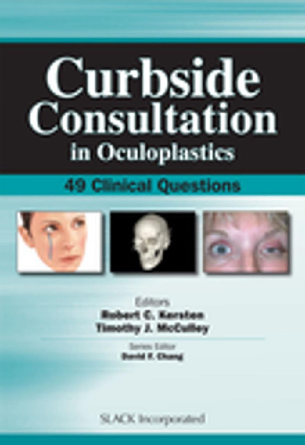 Big bigCover of Curbside Consultation in Oculoplastics