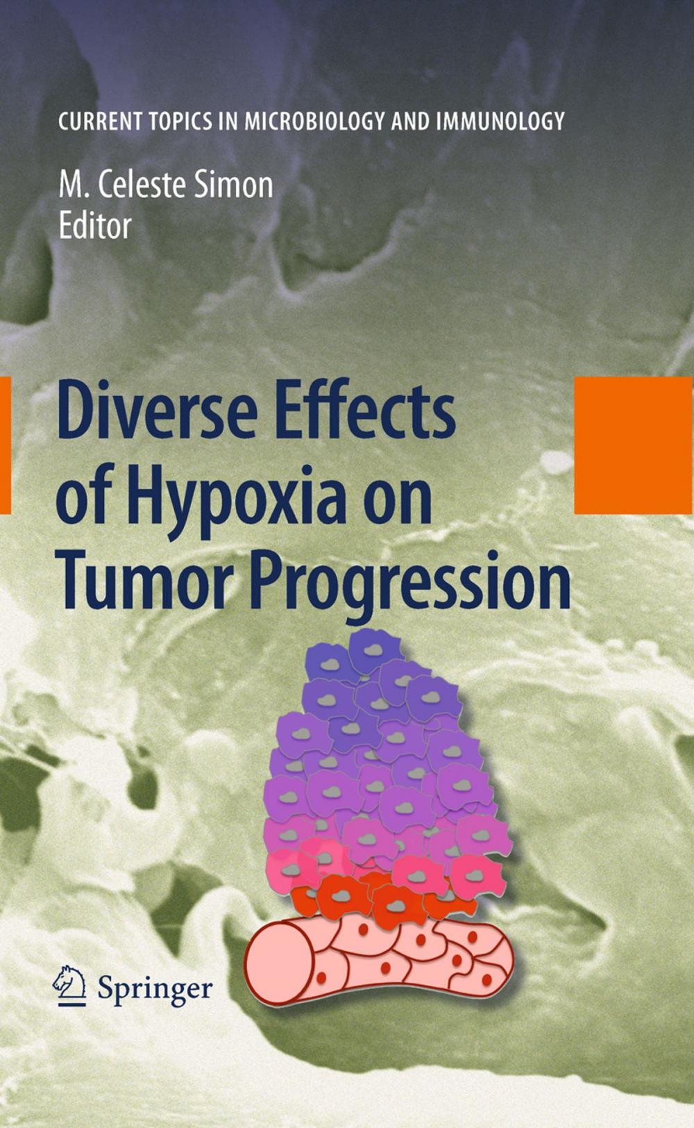 Big bigCover of Diverse Effects of Hypoxia on Tumor Progression