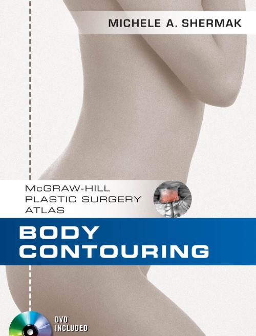 Cover of the book Body Contouring by Michele A. Shermak, McGraw-Hill Education