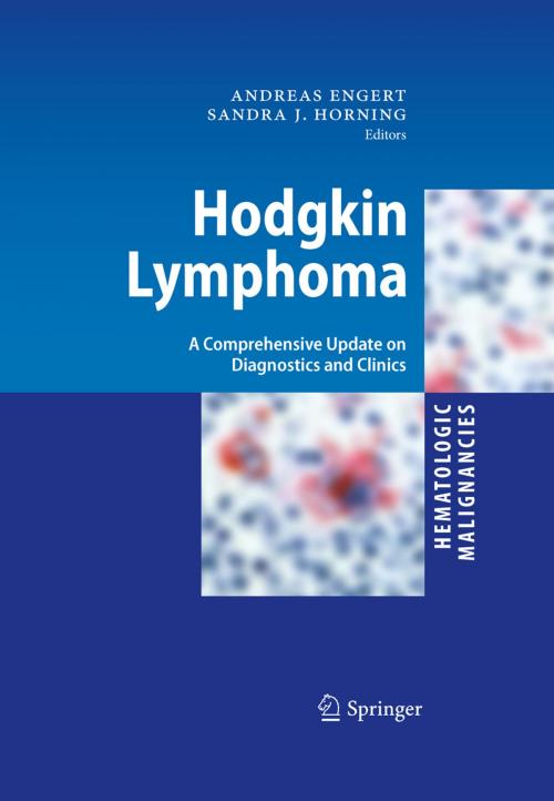 Cover of the book Hodgkin Lymphoma by , Springer Berlin Heidelberg